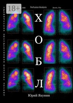 Обложка книги «ХОБЛ. Хроническая обструктивная болезнь лёгких» — Юрий Николаевич Якунин