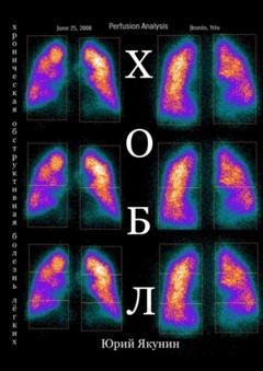 Обложка книги «ХОБЛ. Хроническая обструктивная болезнь лёгких» — Юрий Николаевич Якунин